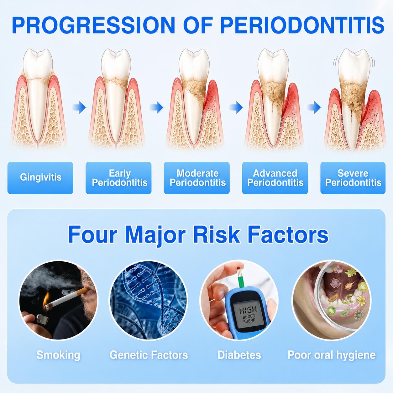 Progression of periodontitis