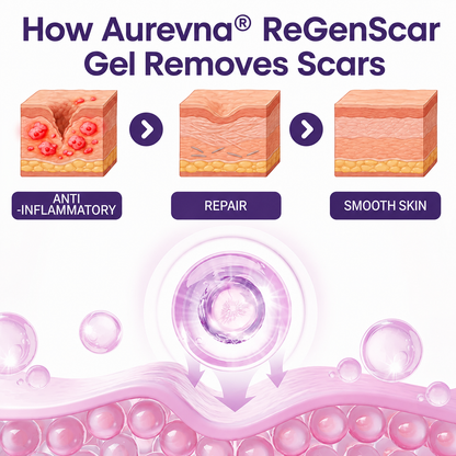 Aurevna® ReGenScar Stem Cell Scar Gel
